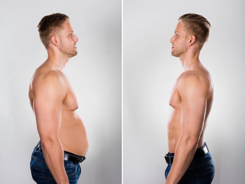 A man is shown before and after his weight loss.