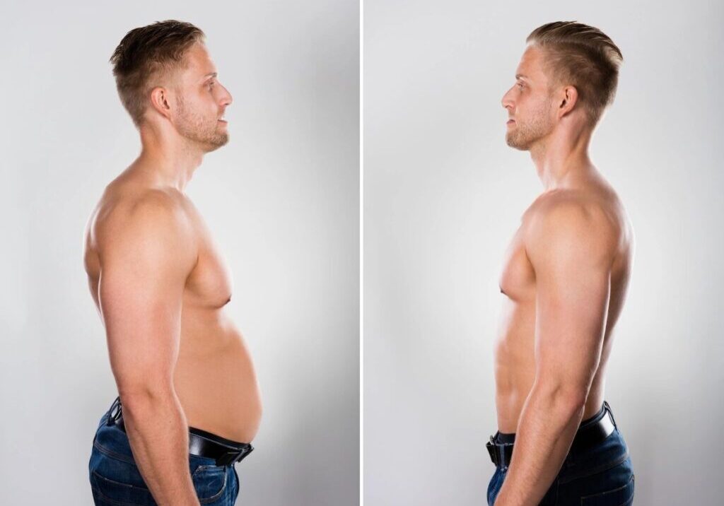 A man is shown before and after his weight loss.